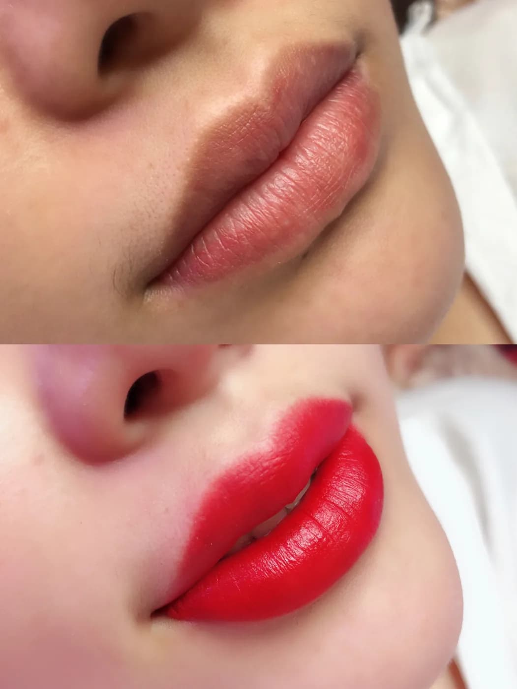Lips
