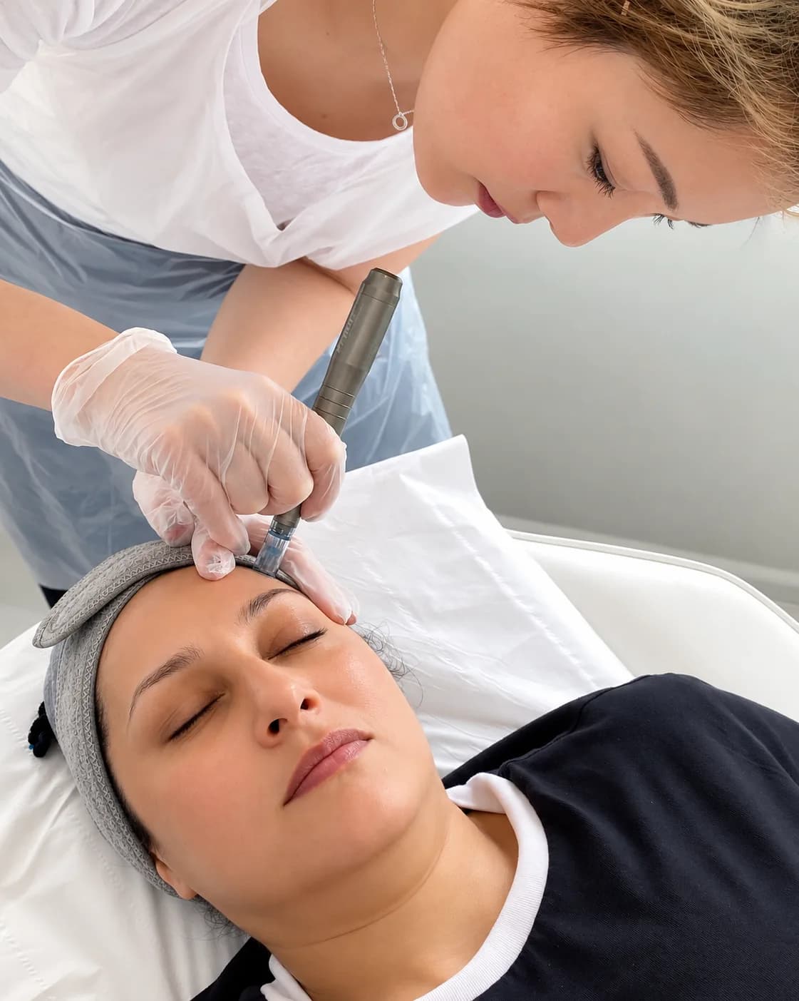 Micro Needling 