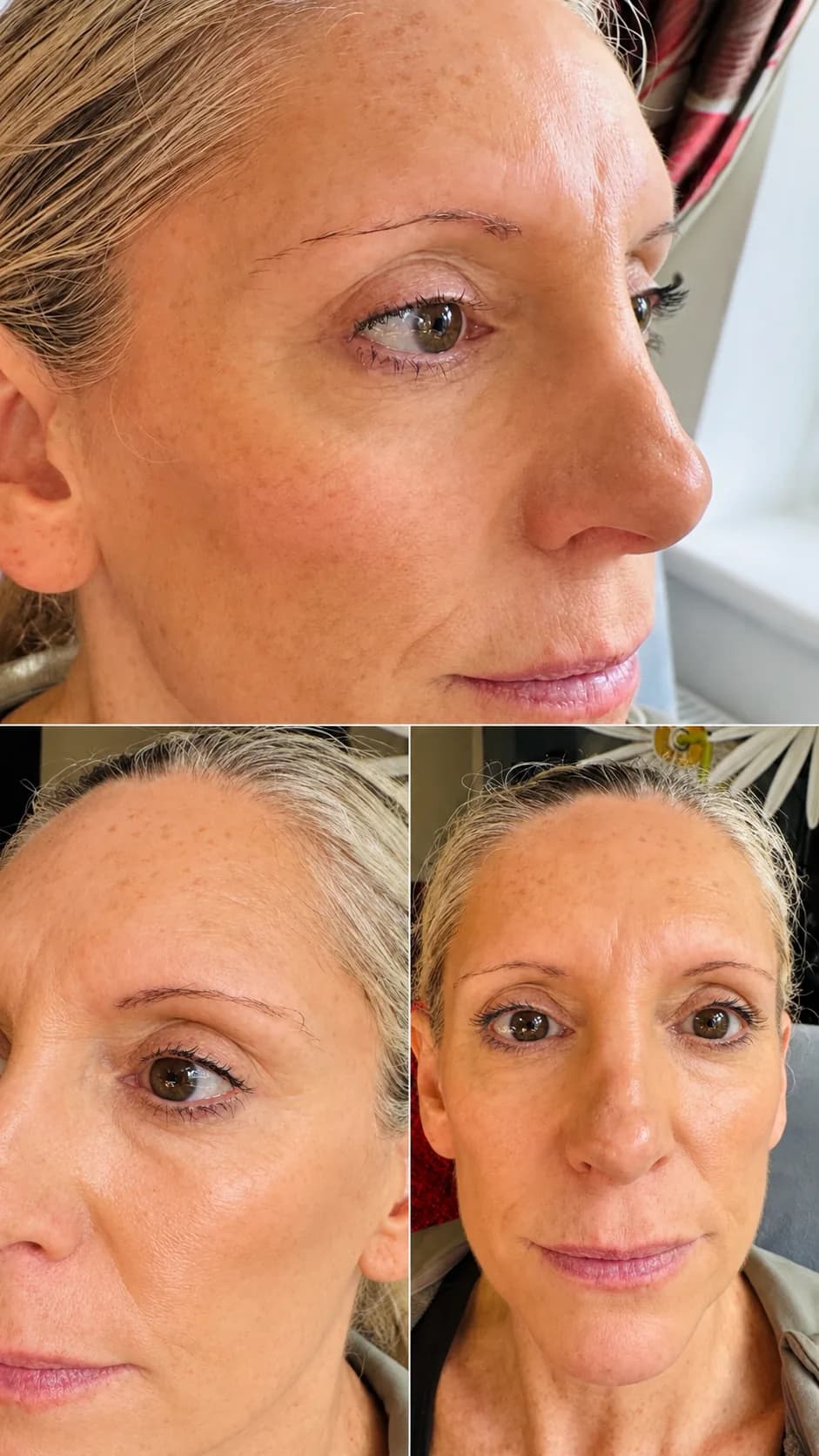 Before Microblading
